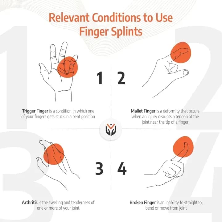Mallet Finger Splint Very Simple Device, Maintains Distal Interphalangeal Joint Dorsiflexion Functional Position