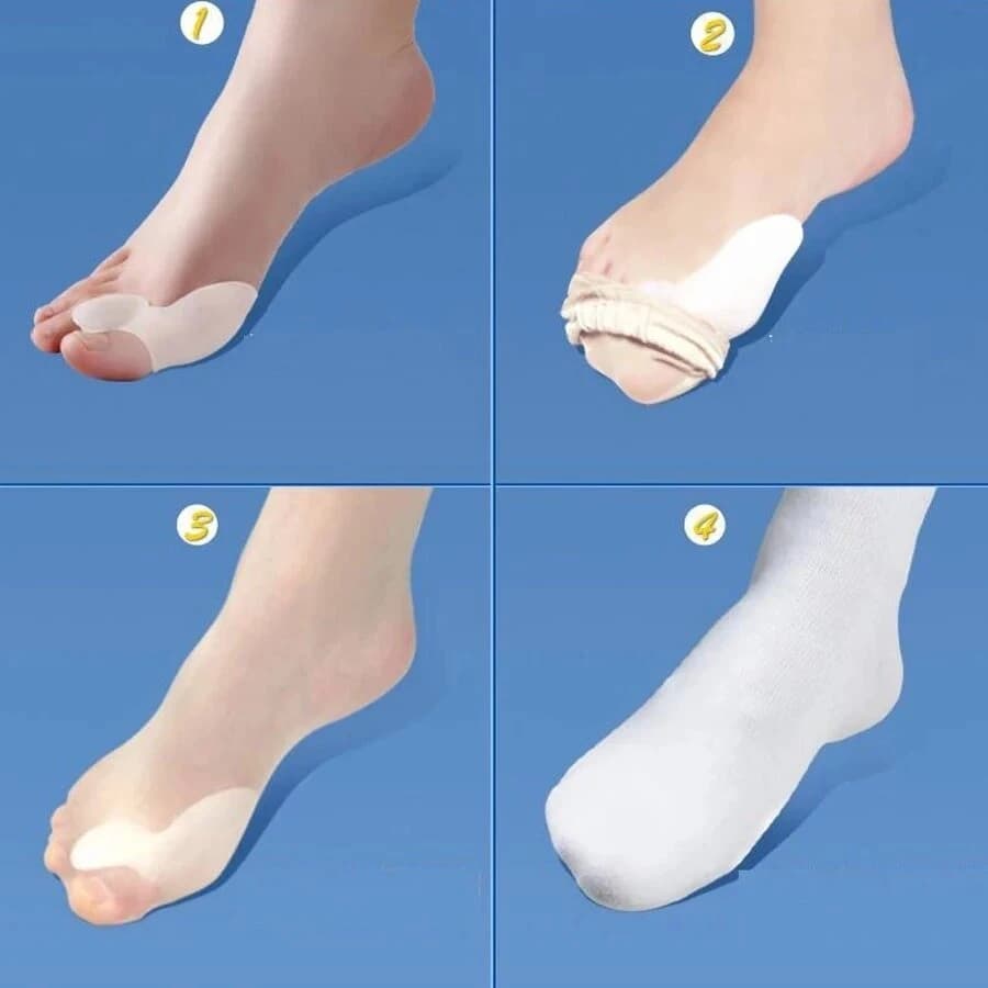 2 Pcs Silicone Gel Bunion Splint Big Toe Separator Overlapping Spreader Corrector Hallux Valgus Foot Massager C147