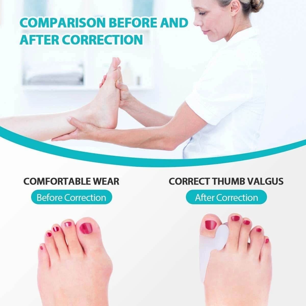 2 Pcs Silicone Gel Bunion Splint Big Toe Separator Overlapping Spreader Corrector Hallux Valgus Foot Massager C147