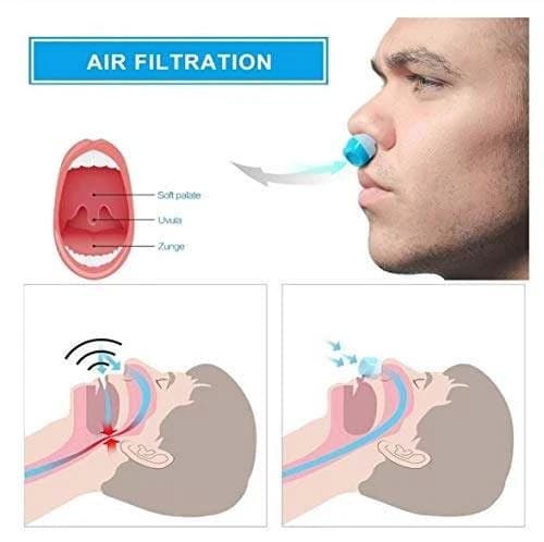 Anti-Snoring Device For Men and Women