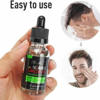 Picture of Beard Growth Solution Oil For Men – 30Ml